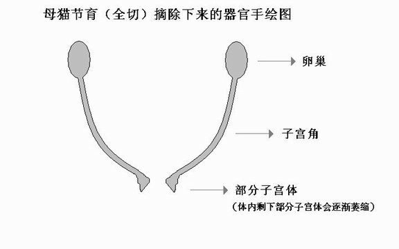 图解子宫卵巢摘除术